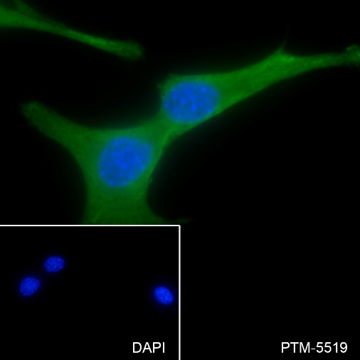 Anti-NSE Rabbit mAb