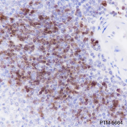 Anti-TCL1 Rabbit mAb