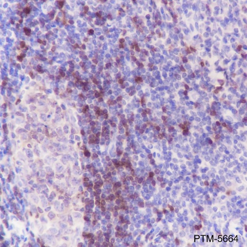 Anti-TCL1 Rabbit mAb