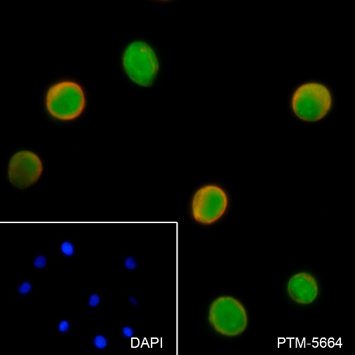Anti-TCL1 Rabbit mAb