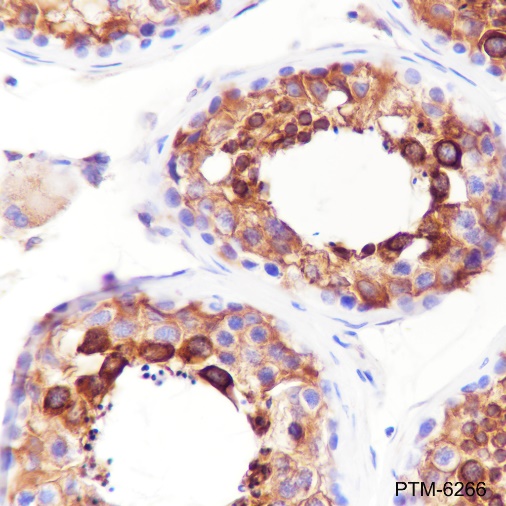 Anti-BAP29 Rabbit mAb