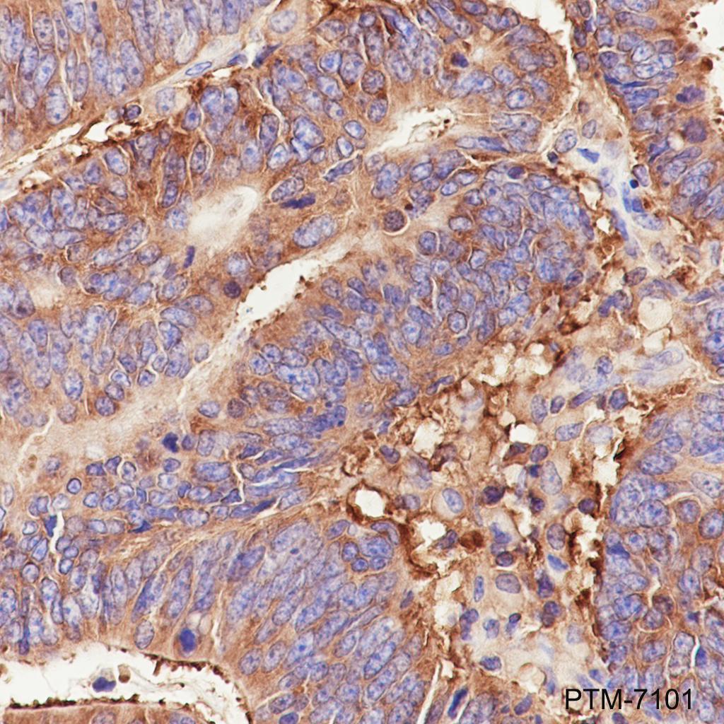 Anti-eIF3G Rabbit mAb