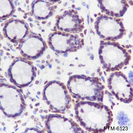 Anti-HMGB1 Rabbit mAb