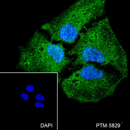 Anti-IKK alpha Rabbit mAb