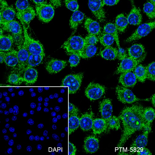 Anti-IKK alpha Rabbit mAb