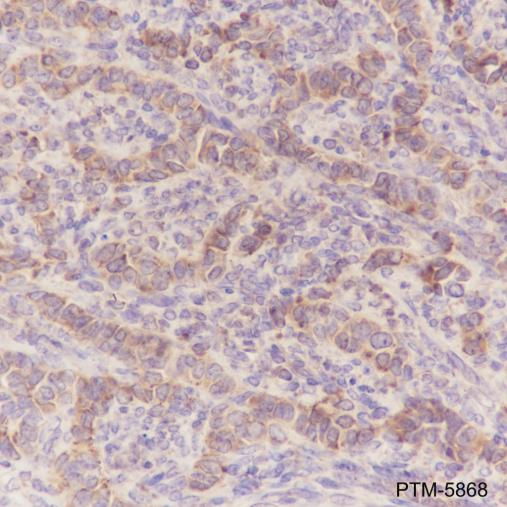 Anti-ATG5 Rabbit mAb