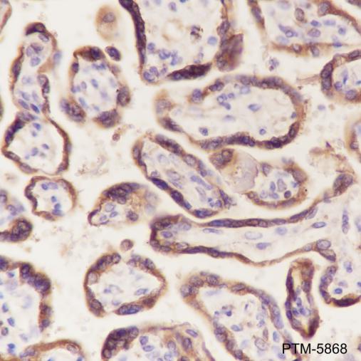 Anti-ATG5 Rabbit mAb