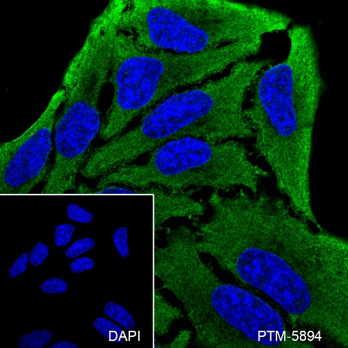 Anti-WNT10B Mouse mAb