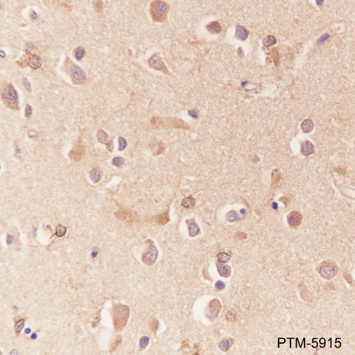 Anti-ApoE Mouse mAb