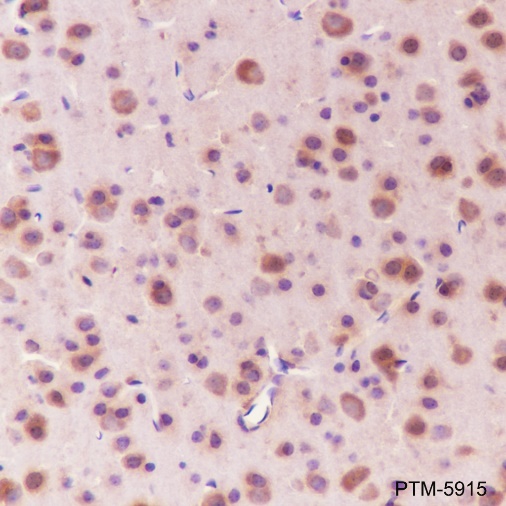 Anti-ApoE Mouse mAb