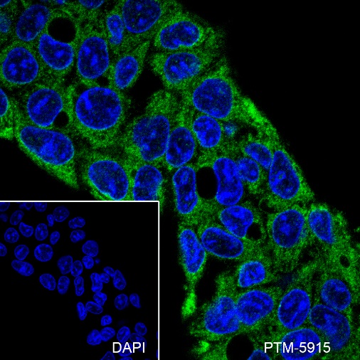 Anti-ApoE Mouse mAb