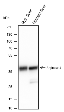 Anti-Arginase-1 Mouse mAb