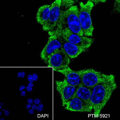 Anti-Arginase-1 Mouse mAb