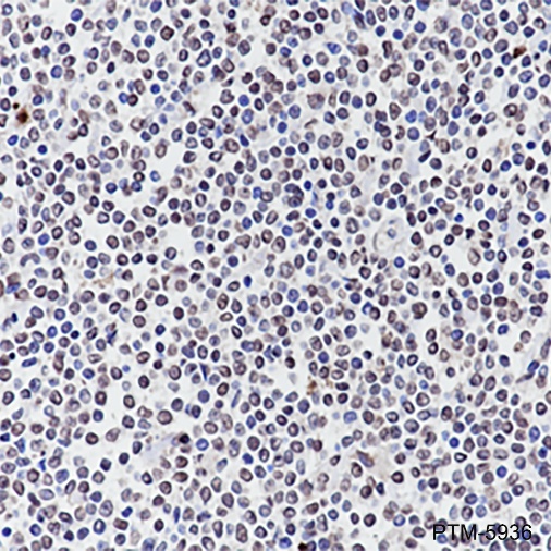 Anti-Cyclin D1 Rabbit mAb