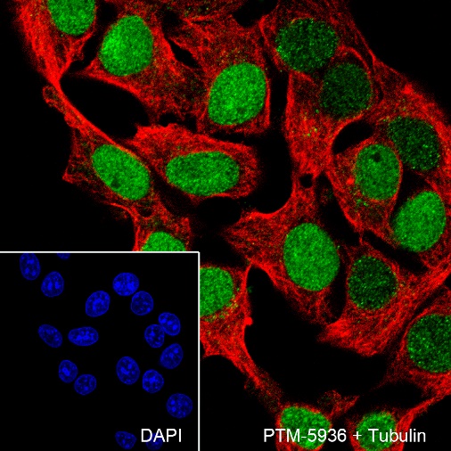 Anti-Cyclin D1 Rabbit mAb