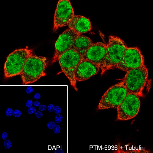 Anti-Cyclin D1 Rabbit mAb