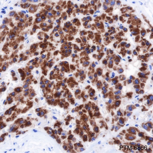 Anti-MAO-A Rabbit mAb
