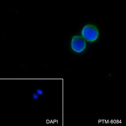 Anti-BAFF-R/TNFRSF13C Mouse mAb