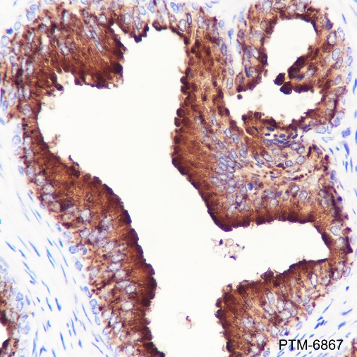 Anti-KIR3DL1 Rabbit mAb