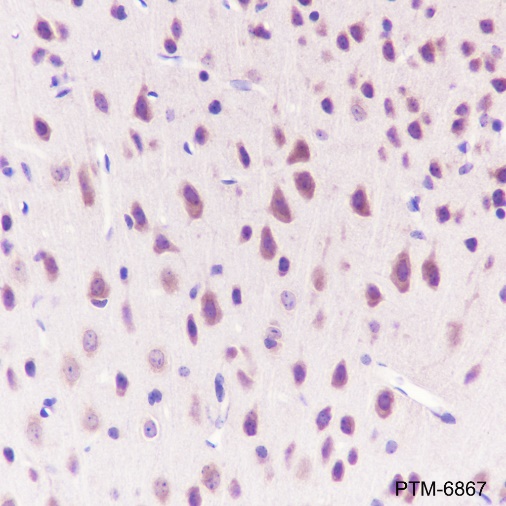 Anti-KIR3DL1 Rabbit mAb