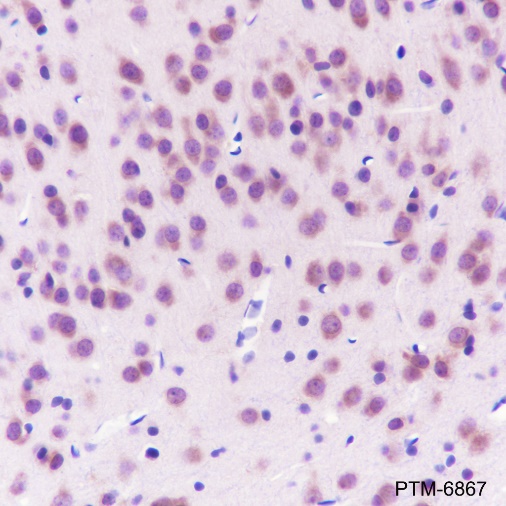 Anti-KIR3DL1 Rabbit mAb