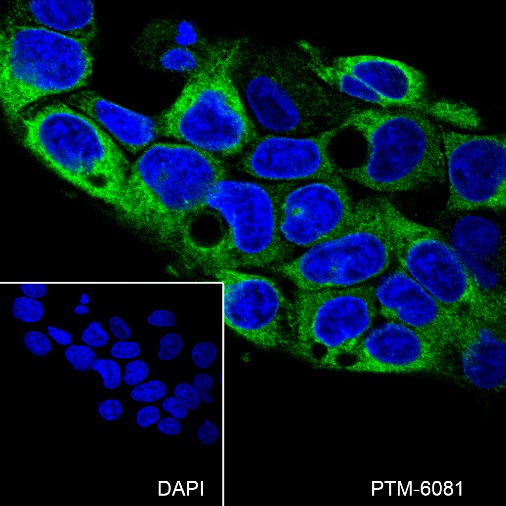 Anti-Transferrin Mouse mAb
