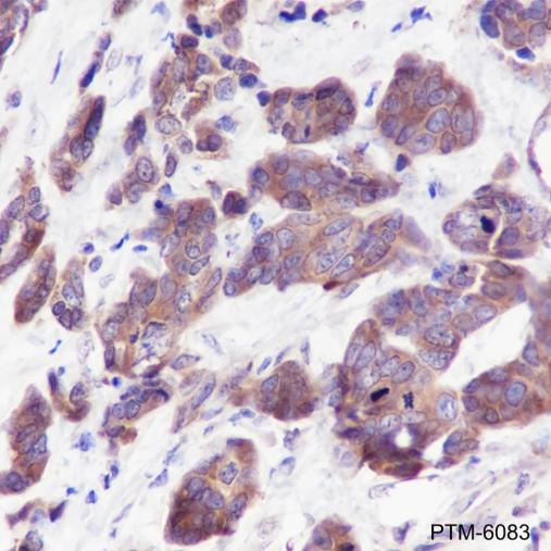 Anti-FOXO3a Mouse mAb