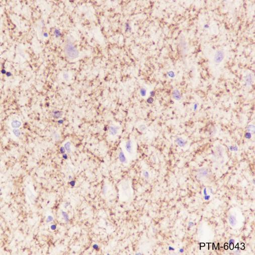 Anti-SIRT2 Mouse mAb