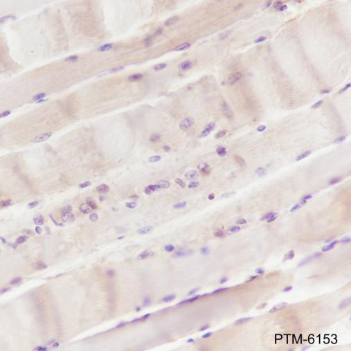 Anti-MEK6/MKK6 Mouse mAb