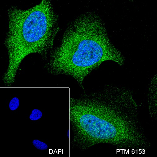 Anti-MEK6/MKK6 Mouse mAb
