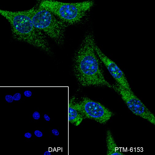 Anti-MEK6/MKK6 Mouse mAb