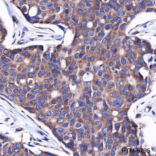 Anti-DDX3 Rabbit mAb