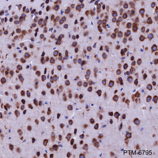 Anti-DDX3 Rabbit mAb