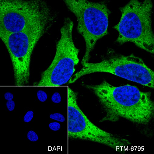 Anti-DDX3 Rabbit mAb
