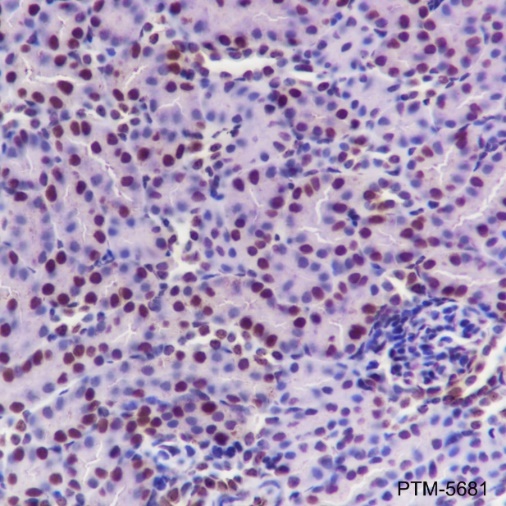 Anti-SOD1 Rabbit mAb