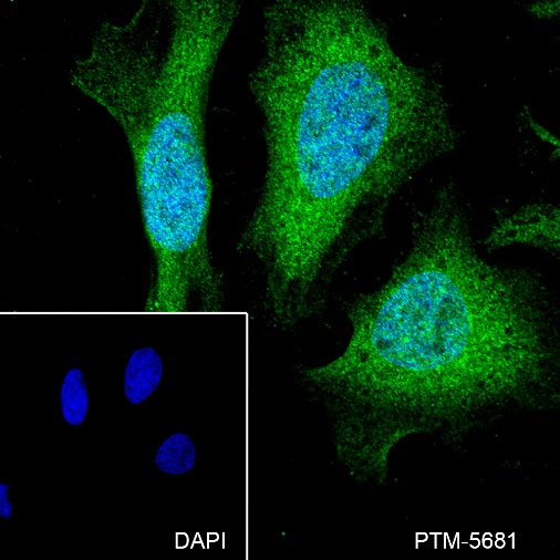 Anti-SOD1 Rabbit mAb