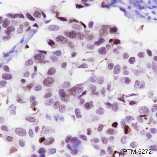 Anti-Cleaved PARP1 p25 Rabbit mAb