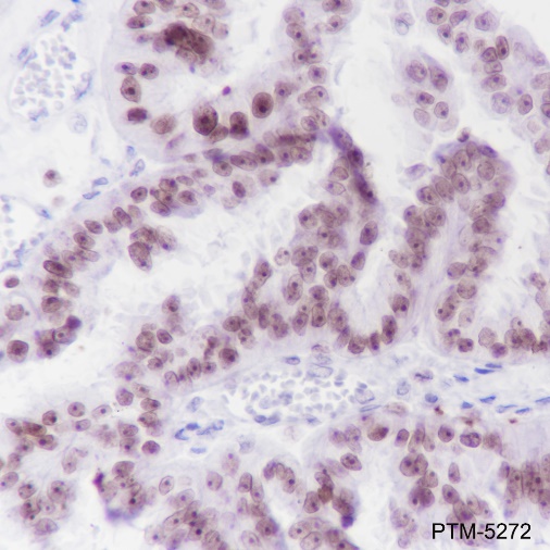 Anti-Cleaved PARP1 p25 Rabbit mAb