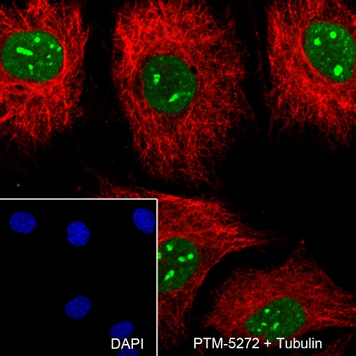 Anti-Cleaved PARP1 p25 Rabbit mAb