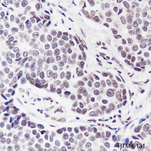 Anti-CDK4 Rabbit mAb