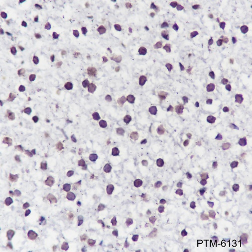 Anti-CDK4 Rabbit mAb
