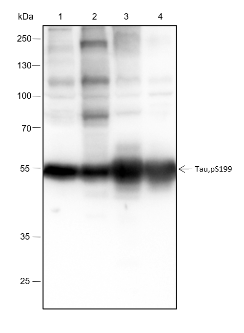 Anti-Phospho-Tau (Ser199) Rabbit mAb
