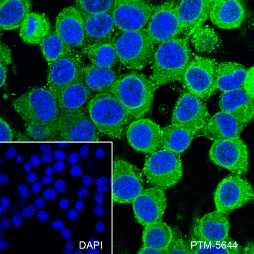 Anti-Phospho-Tau (Ser199) Rabbit mAb