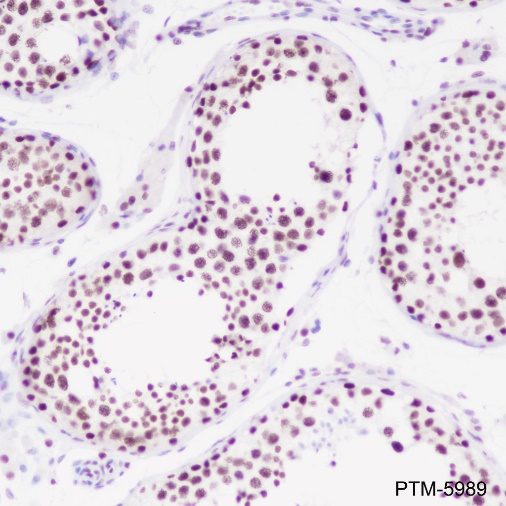 Anti-PARP1 Rabbit mAb