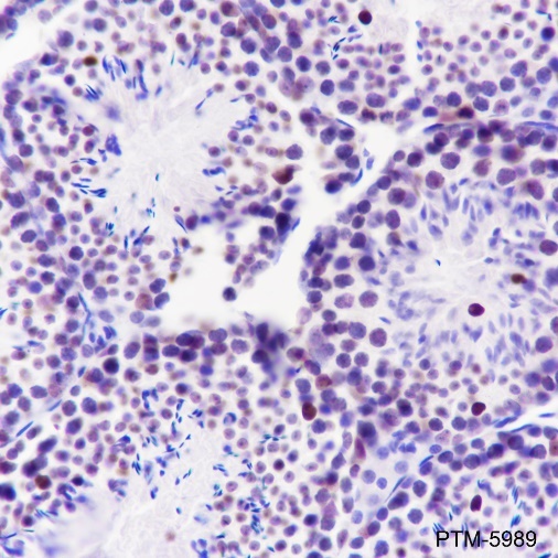 Anti-PARP1 Rabbit mAb
