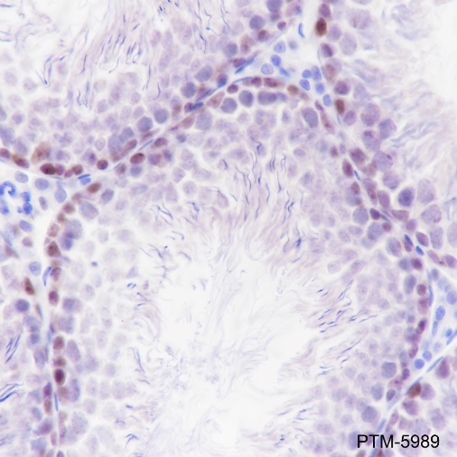 Anti-PARP1 Rabbit mAb
