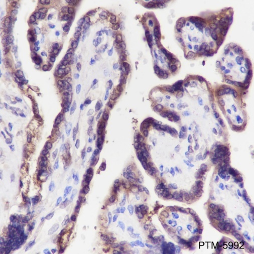 Anti-GST3/GSTP1 Rabbit mAb