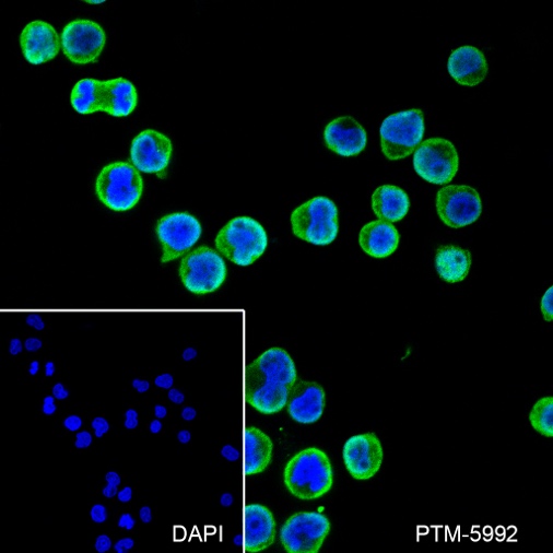 Anti-GST3/GSTP1 Rabbit mAb