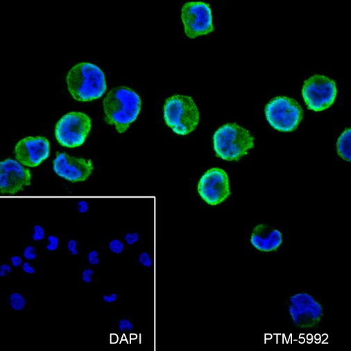 Anti-GST3/GSTP1 Rabbit mAb