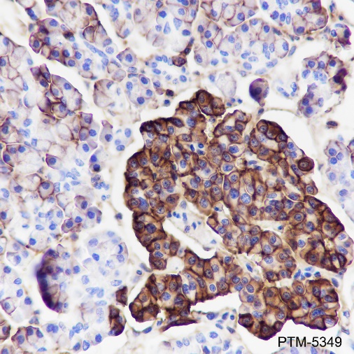 Anti-CD99 Rabbit mAb